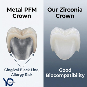 Couronnes temporaires en résine pour facettes dentaires, résine blanchissante, produits dentaires, couronnes en céramique, zircone - Product Image 2