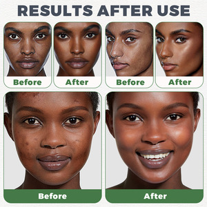 Elaimei hydrates สมดุลผิวมันสิวลดสีดำสบู่ดำสครับผิวขาวสบู่อินทรีย์แอฟริกันสีดำ - Product Image 4