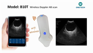 Ecógrafo Oftálmico Doppler Color Inalámbrico B10T con Marcado CE, 128E 8/11mhz, Escaneo B, Ultrasonido <span class=keywords><strong>Ocular</strong></span> para la Visión - Product Image 2