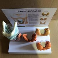 KyrenMed Thyroïde Modèle pathologique Thyroïde Larynx Maladies Modèle éducatif Nodule Goitre Thyroïdite Mastoïde Cancer