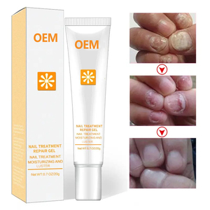 Champignon Nail Cream Herbal <span class=keywords><strong>Finger</strong></span> Toe Onychomycose Pommade Champignons Infection Paronychia Care - Product Image 5