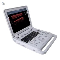 Alat USG Doppler Warna Portabel Veteriner Multifungsi dengan Tombol Kontrol Ramah Pengguna, Pasokan Grosir untuk Klinik Hewan