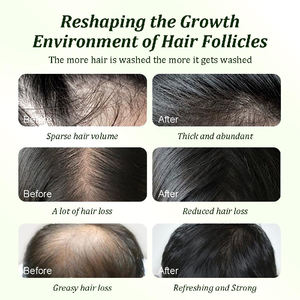 <span class=keywords><strong>Champú</strong></span> de aceite de Batana de etiqueta privada <span class=keywords><strong>para</strong></span> el crecimiento <span class=keywords><strong>del</strong></span> cabello con Romero <span class=keywords><strong>champú</strong></span> nutritivo y rejuvenecedor anticaída <span class=keywords><strong>para</strong></span> hombres y mujeres - Product Image 4