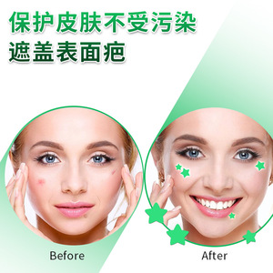 Patchs anti-acné qui brillent dans le noir, en forme d'étoile, fins et respirants, pour adolescents et adultes, 40 pièces - Product Image 3