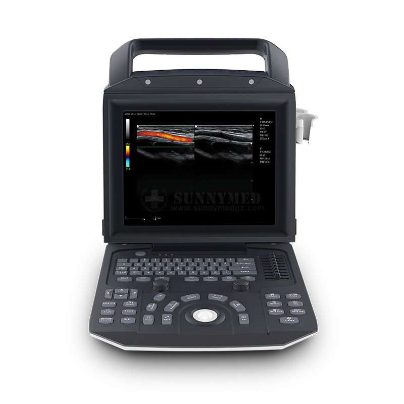 SYA M5 Color Doppler Laptop Cardiac