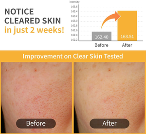 Almohadillas Faciales No3 Radiance Glowing Jumbo Essence Pad, Iluminadoras e Hidratantes con Niacinamida y Ácido Hialurónico - Product Image 5