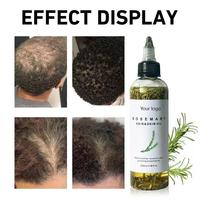 Sérum Réparateur Capillaire Biologique et Naturel au Romarin Anti-Chute, Traitement au Romarin, Sérum Stimulant la Croissance, Huile Essentielle pour Cheveux