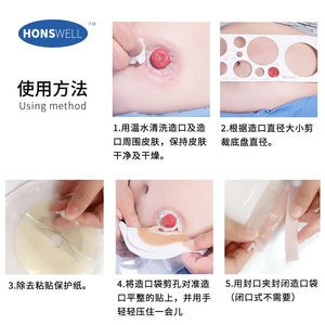 Bolsa de ostomía, bolsa anal, estoma médico, base hidrocoloide de una pieza con apertura, cierre anal artificial, exportación 10 unidades - Product Image 5