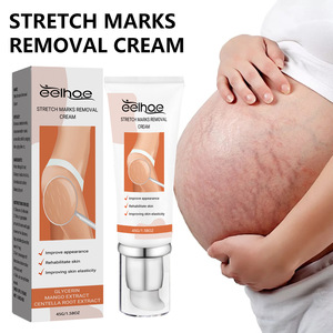 <span class=keywords><strong>Crema</strong></span> reparadora de estrías de fórmula vegana más vendida, piel suave de acción rápida, suave, no irritante <span class=keywords><strong>para</strong></span> el abdomen, muslos, pecho - Product Image 2