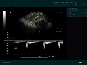 Échographe portable <span class=keywords><strong>Edan</strong></span> <span class=keywords><strong>Dus</strong></span> <span class=keywords><strong>60</strong></span>, appareil d'échographie BW, dispositif médical - Product Image 5