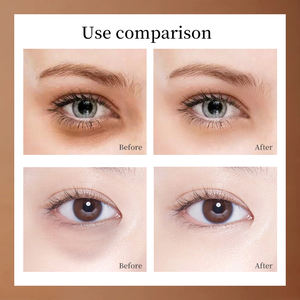 2022 plus récent vente chaude bio pulpe riz visage yeux sérum ensemble beauté crème Essence éclaircissant 24k or soins de la peau ensemble - Product Image 4