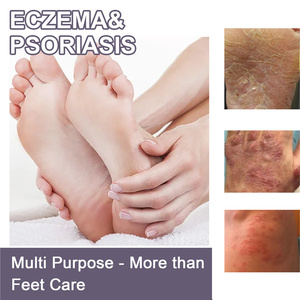 Eelhoe Spray de 30 ml para <span class=keywords><strong>Eczema</strong></span> y Psoriasis, Inflamación de la Piel, Enrojecimiento, Picazón, Tratamiento Líquido para Psoriasis, <span class=keywords><strong>Eczema</strong></span> y Dermatitis - Product Image 4