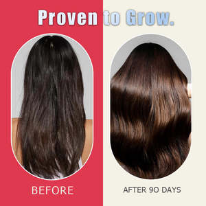 Comprimés de complément alimentaire pour la croissance des cheveux en marque privée, nourrissent les cheveux clairsemés, réduisent la chute et augmentent l'épaisseur des cheveux - Product Image 4