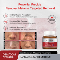 Crème professionnelle éclaircissante pour les taches brunes et les taches de rousseur, à l'acide azélaïque et à l'acide salicylique, pour le mélasma, les taches de vieillesse et l'hyperpigmentation, exfoliante douce