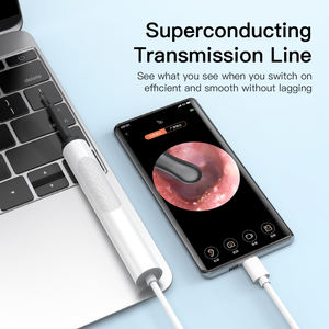 B5 통합 USB 유선 의료용 안전 귀지 제거 도구 카메라 전동 귀 청소 이경 - Product Image 4