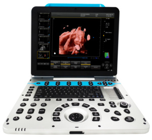 Daiwei DW-P30, Ecógrafo Doppler Color para Animales Veterinarios, Venta al por Mayor en China, con Aparato de Diagnóstico Ultrasónico 3D/4D/5D de 15 Pulgadas - Product Image 3