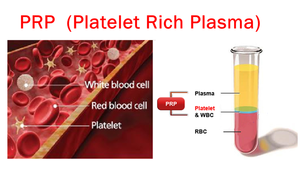 Centrifuga per Cellule Staminali con Tappi Sigillanti per la Sicurezza - Product Image 4