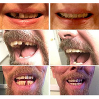 3 Teintes/kit – Prothèses dentaires temporaires, fausses dents, dentaduras, sourires parfaits, placages, adaptatifs, flexibles, avec pâte dentaire et attaches