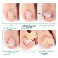Onyx Nail Correctors Kit de correction des ongles incarnés Rouleaux à ongles Patches pour ongles Kit de correction des ongles incarnés