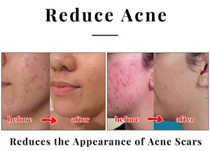 สบู่โคจิกแอซิด 65 กรัม × 2 ก้อน รับผลิตแบรนด์ส่วนตัว ลดเลือนจุดด่างดำ สูตรวีแกน กลิ่นมะพร้าว - Product Image 6