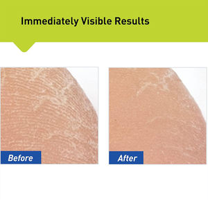 Zulangzhong <span class=keywords><strong>Pies</strong></span> naturales <span class=keywords><strong>Pies</strong></span> malolientes Picazón Sudoración Beriberi Hongo <span class=keywords><strong>Crema</strong></span> para el cuidado de la salud 16g - Product Image 4