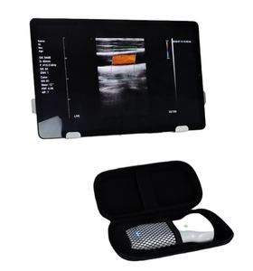KONTED Ultrasound Nirkabel Multifungsi, Doppler Warna Cocok untuk Pemeriksaan Fisik/Keadaan Darurat - Product Image 6