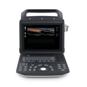 Marca Zoncare Ultrasonido M5 2025 con bajo <span class=keywords><strong>precio</strong></span> Escáner de ultrasonido de examen abdominal Doppler a color de mano - Product Image 1