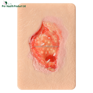 Mô hình mô hạt mãn tính mô phỏng 4 loại mô hạt cho khoa học y tế - Product Image 2