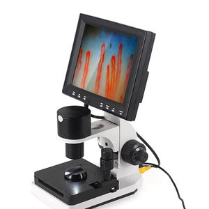 <span class=keywords><strong>Microscope</strong></span> <span class=keywords><strong>USB</strong></span> avec zoom <span class=keywords><strong>400X</strong></span> pour la microcirculation sanguine et le pli des ongles - Product Image 1