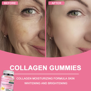 Las gomas multivitamínicas naturales de colágeno ayudan a mantener la energía, las gomitas nutritivas de colágeno para la piel - Product Image 3