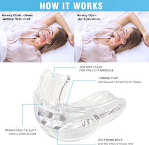 Bocchino Anti-russamento, paradenti russanti per uomini e donne Ultra Soft - Product Image 3