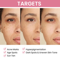 Soins de la peau coréens éclaircissant Alpha arbutine crème visage blanchissante peau noire blanchissant Anti-âge crème fournisseurs pour peau foncée