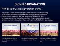 Plateformes laser esthétiques professionnelles de qualité médicale, équipement esthétique en gros, capteurs E-Light IPL SmartSkin AI