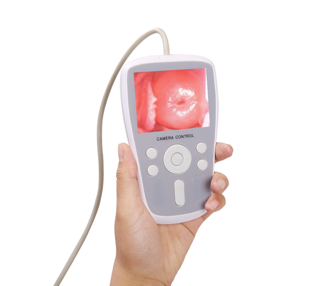 Handheld Video Surgical Instrument Professional HD Gynecological Video Vaginoscope Equipment