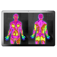 Caméra thermique médicale : Sensibilité, fiabilité et performances optimales pour la surveillance de la santé