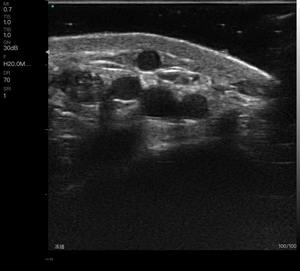 चेहरे के फिलर्स के लिए HF-L4PC 192 तत्व (16-20mhz) - Product Image 5