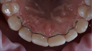 Linterna Intraoral Dental Eléctrica Inteligente con LED Inteligente para Procedimientos Dentales, Certificación CE - Product Image 5