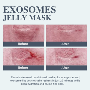 2025 OEM Exo Certains rajeunissement de la peau Exoso & PDRN Jelly Peel off Masque anti-âge anti-acné Hydratant Exo Certains masques à cellules souches - Product Image 6