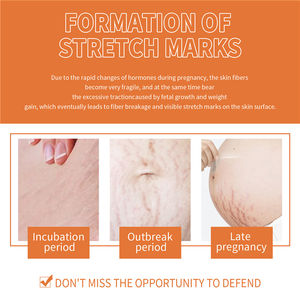 OEM Doğal Bitki Özlü Çatlak İzi Onarıcı Yağ, Hamilelik Cilt Bakımı, Yara İzi Yatıştırıcı ve Nemlendirici Destek 100ml - Product Image 5