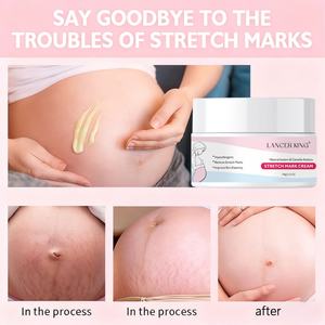Crème anti-vergetures naturelle pour femmes enceintes, hydratant, vente en gros et personnalisation - Product Image 3