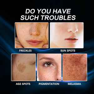 ครีมบำรุงผิวหน้าวิตามินซีสูตรผสมวอลนัทแบบ OEM ผลิตตามความต้องการ ช่วยให้ผิวขาวกระจ่างใส ลดเลือนริ้วรอย ต่อต้านริ้วรอยแห่งวัย ลดรอยสิว ช่วยให้ผิวชุ่มชื้น กระชับผิว - Product Image 5