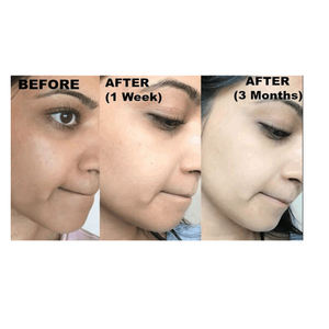 <span class=keywords><strong>Savon</strong></span> Purifiant et Blanchissant Original à l'Acide Kojique avec Huile de Coco et Huile d'<span class=keywords><strong>Arbre</strong></span> à Thé Rafraîchissante pour Éliminer les Taches Brunes - Product Image 4