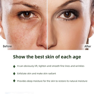 Chống lão hóa chăm sóc da Kit Facial Set nuôi dưỡng mặt kem & lotion dưỡng ẩm sâu Squalane Bộ chăm sóc da (mới) - Product Image 5