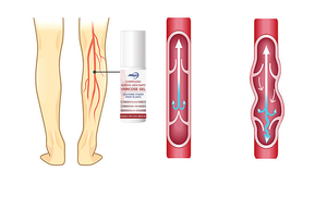 Crème pour <span class=keywords><strong>varices</strong></span> <span class=keywords><strong>Traitement</strong></span> des <span class=keywords><strong>varices</strong></span> pour le soulagement de la douleur des jambes 50g OEM ODM - Product Image 4