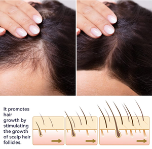 Tự nhiên tăng trưởng tóc huyết thanh cho phụ nữ rụng tóc mọc lại - Product Image 2