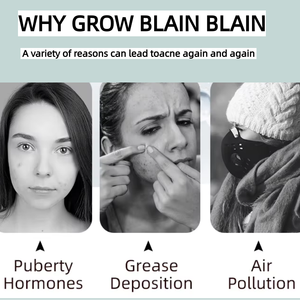 Bifidobacterium Ferment lisat Perawatan Jerawat Gel Pengontrol Minyak Jerawat mengurangi semua jenis kulit tanpa hewan Gel Anti Jerawat - Product Image 2