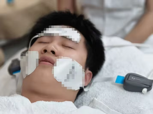 Appareil portable Emrf Peface Facial Hiems pour le raffermissement de la peau, le lifting du visage par micro-courant, le rajeunissement de la peau, anti-âge - Product Image 6