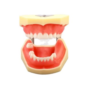 Modèle dentaire Dt M2030 : Dents anatomiques manquantes pour l'enseignement des implants et la science médicale - Product Image 2