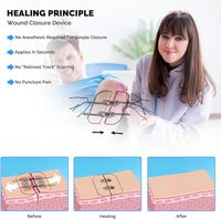 Zip Stitch Sutures Butterfly Band aids Zip Stitches pour le soin des plaies Kit de fermeture de lacération