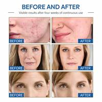 Crème magique OUHOE, crème pour le visage multi-usages, nettoyage en profondeur naturel, anti-âge, anti-rides, hydratante, nourrissante, réparation de l'acné